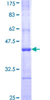 12.5% SDS-PAGE Stained with Coomassie Blue.